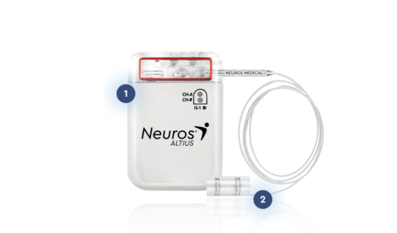 Neuros Medical Secures $56M Series D to Commercialize the Altius® System, an FDA-Approved, Non-Opioid Nerve Stimulation System for Chronic Post-Amputation Pain