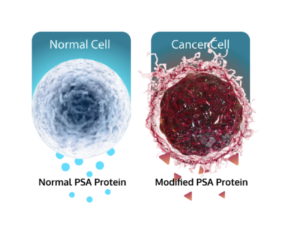 fda-approves-isopsa-cleveland-diagnostics-novel-blood-based-prostate-cancer-test